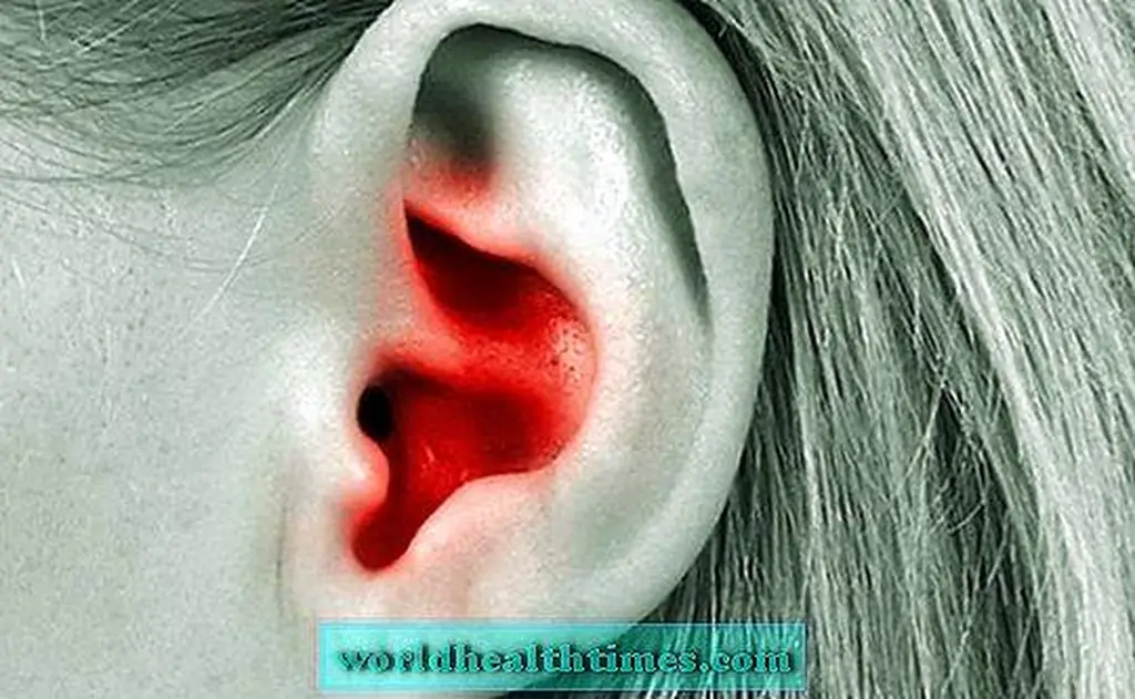 Image Image