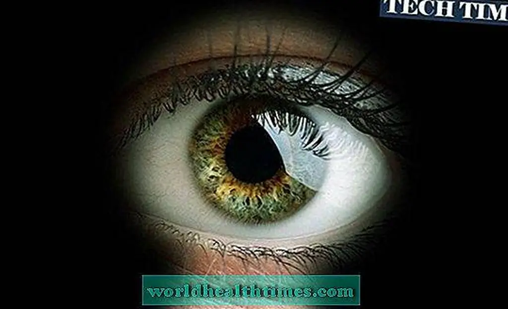 Image Image