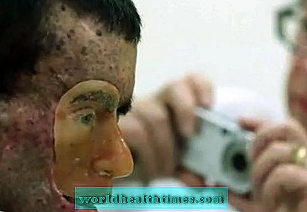 Image Image