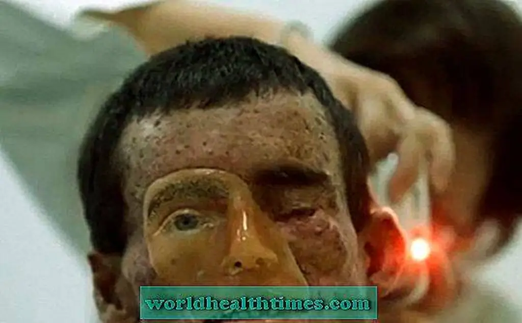Image Image