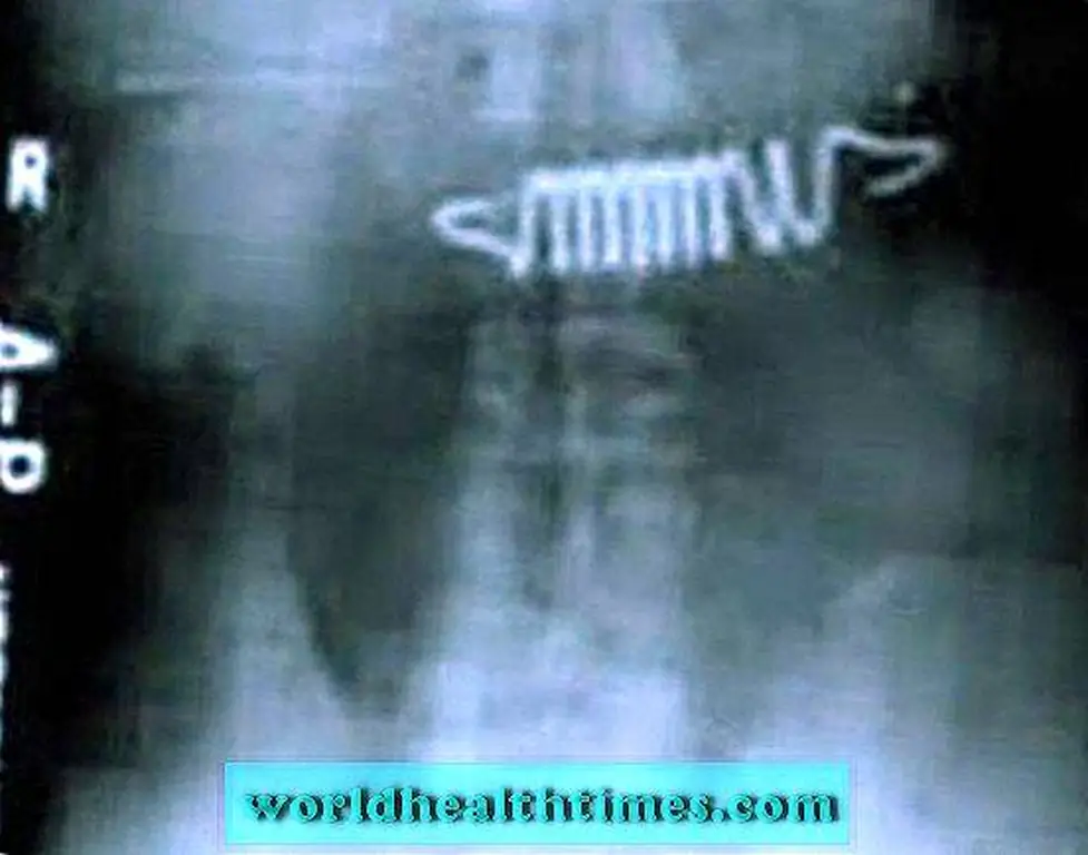 Image Image