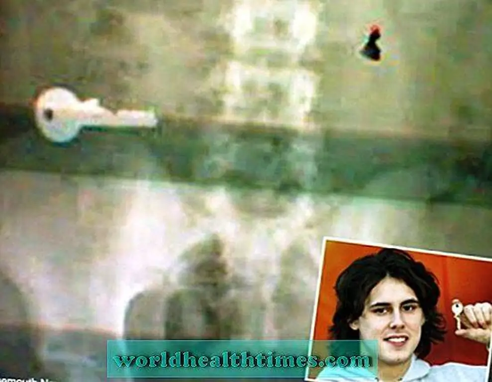 Image Image