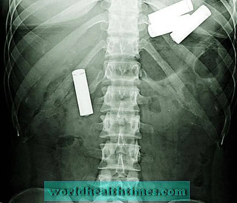 Image Image
