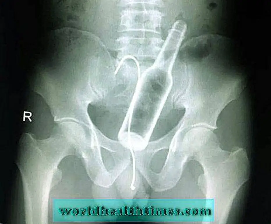 Image Image