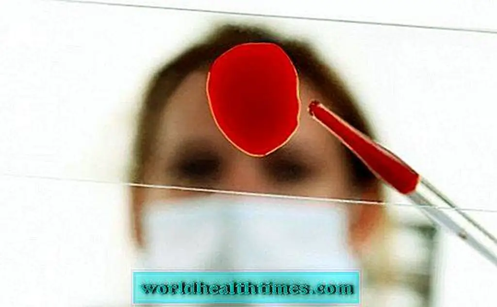 Image Image