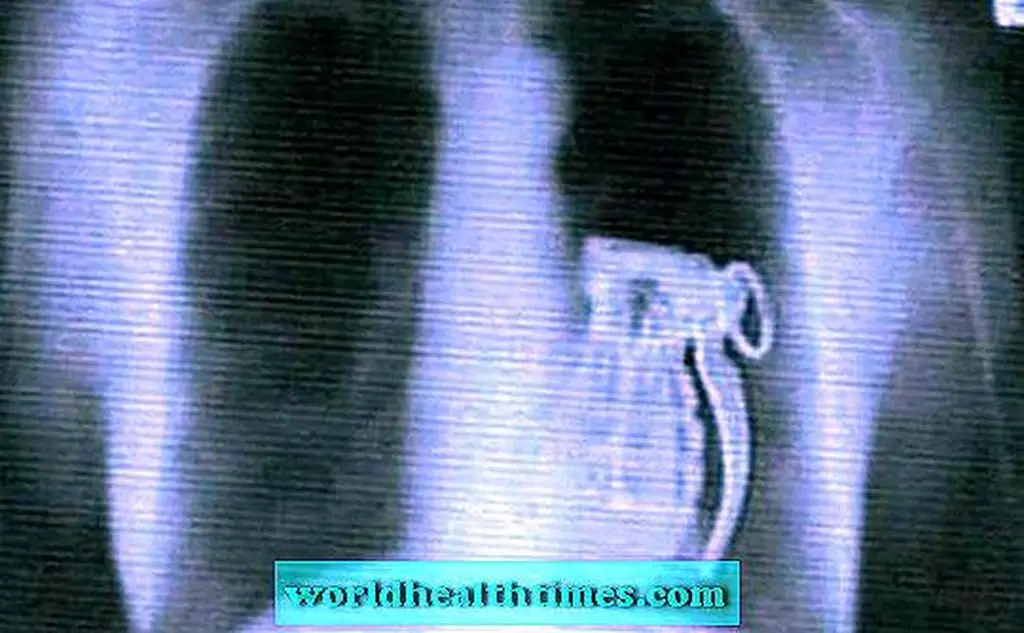 Image Image