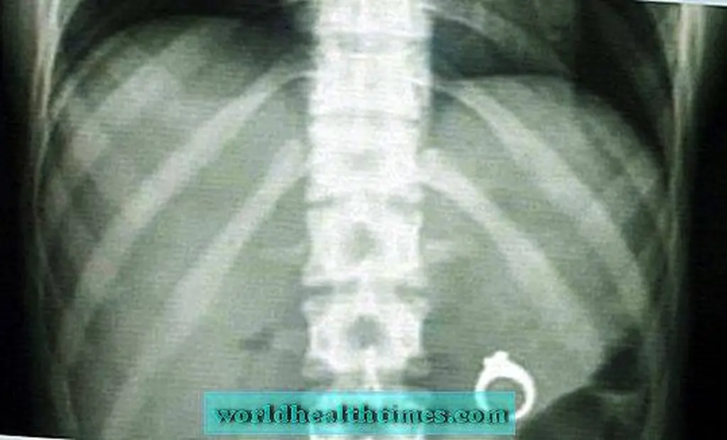 Image Image