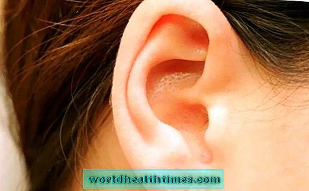 Image Image
