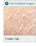 Изображение Cradle Cap