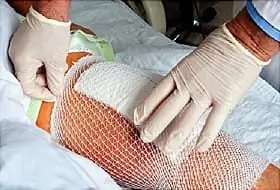 повязка на колено