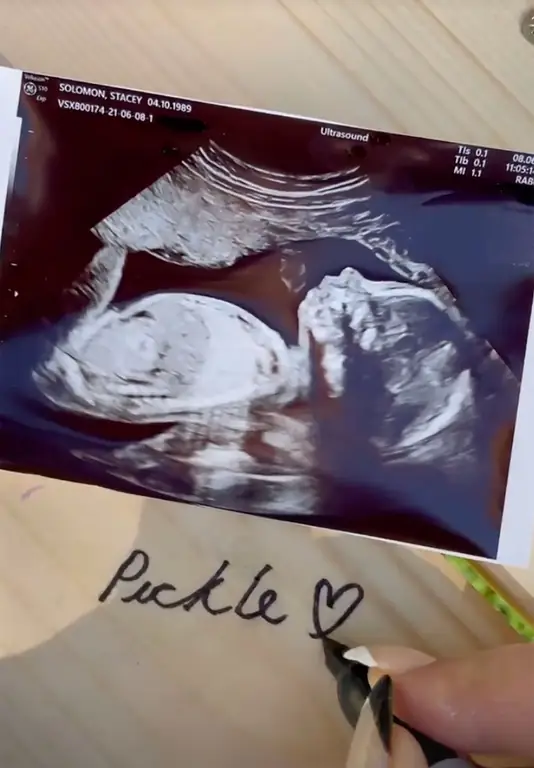 Детское УЗИ