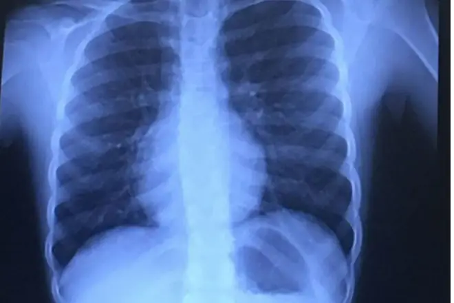 Непоседа спиннер