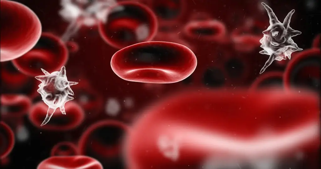 Сепсис у младенцев и детей: признаки, симптомы и лечение