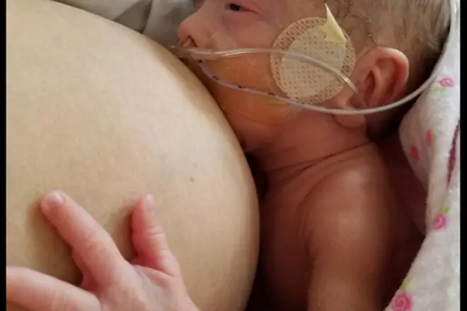 грудное вскармливание недоношенного ребенка