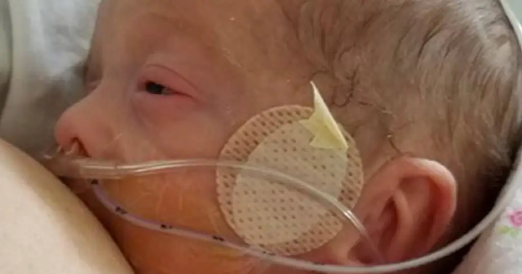 Красивое фото недоношенного ребенка на грудном вскармливании