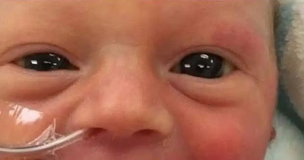 Великолепная фотография, которая запечатлела эту маму во время пребывания в отделении интенсивной терапии