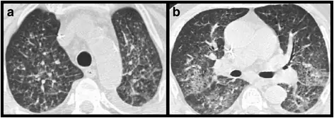 figure4