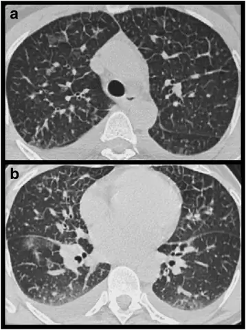 figure7