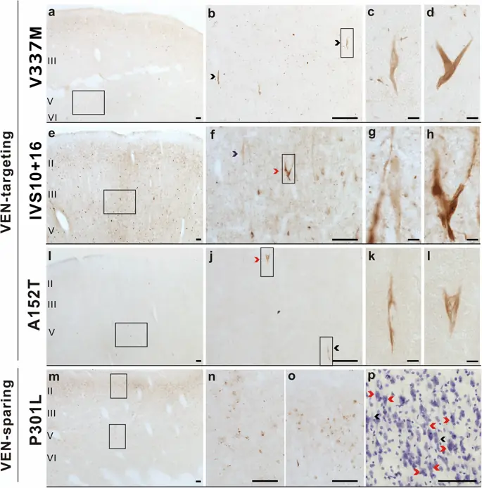 figure4 figure4