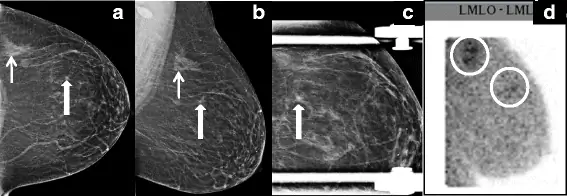 figure4