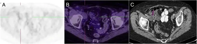 figure9 figure9