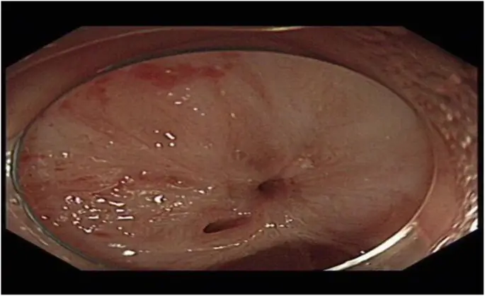 figure11
