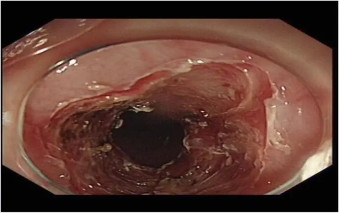 figure12
