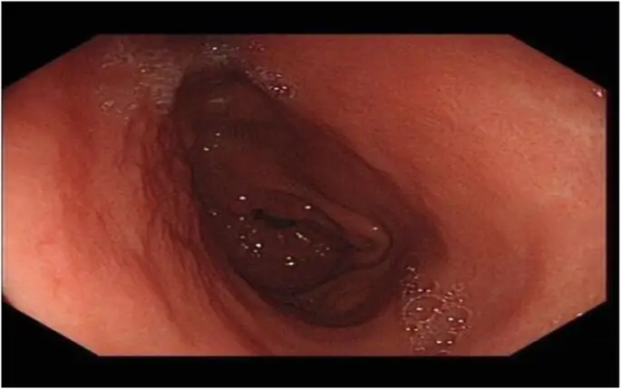 figure13