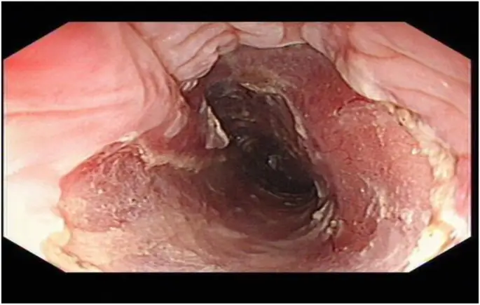 figure5