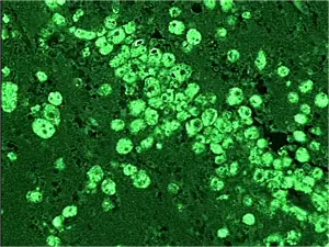 Изображение Balamuthia mandrillaris