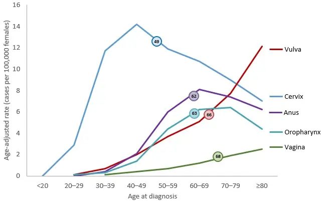 Line chart showing the median age at diagnosis for HPV-associated cancers among women. 49 years for HPV-associated cervical cancer, 67 for HPV-associated vaginal cancer, 66 for HPV-associated vulvar cancer, 62 for HPV-associated anal cancer, and 62 for HPV-associated oropharyngeal cancers