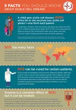 Infographic: 5 Facts You Should Know About Sickle Cell Disease Infographic: 5 Facts You Should Know About Sickle Cell Disease