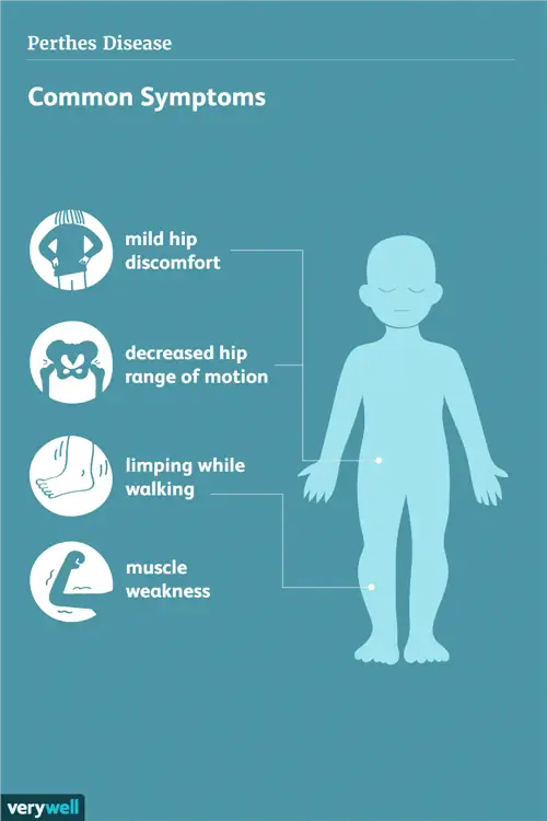 симптомы болезни пертеса