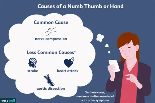 причины онемения большого пальца руки или руки