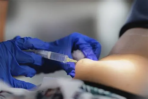 Медицинский работник в перчатках делает инъекцию человеку, получающему липолиз.