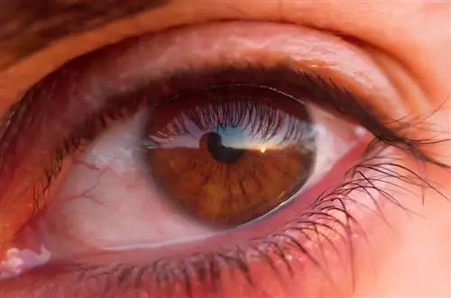 Опухание слезного канала: симптомы, причины, лечение