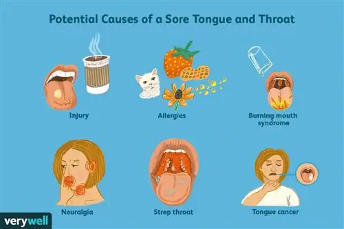 Возможные причины боли в языке и горле