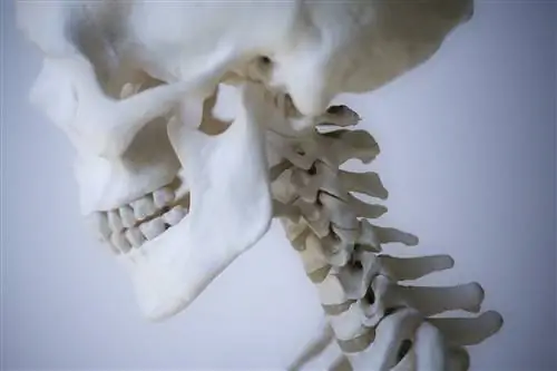 Как травма зубовидного отростка может привести к летальному исходу