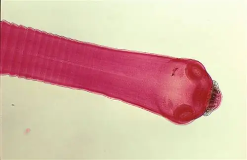 Ленточный червь