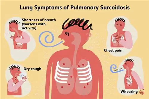 Легочные симптомы легочного саркоидоза - Иллюстрация Микелы Буттиньол