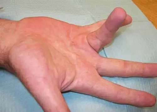 рука с вытянутым безымянным пальцем