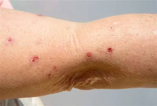 Фотосенсибилизация Реакция на лекарства