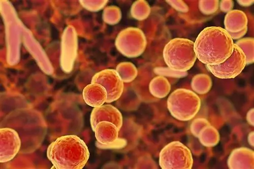 Как диагностируется Mycoplasma Genitalium
