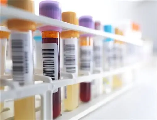 Анализы, которые должен назначать врач с ВЗК