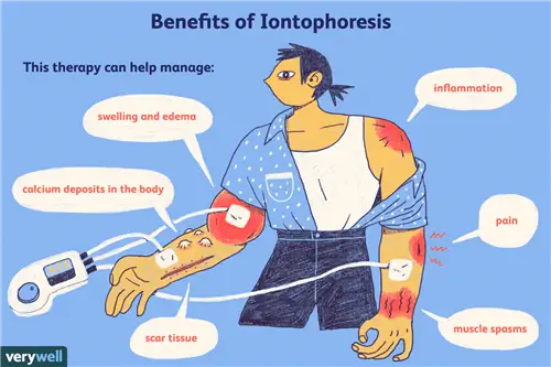 Преимущества ионофореза