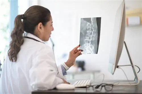 Тракционные шпоры и дегенерация позвоночника