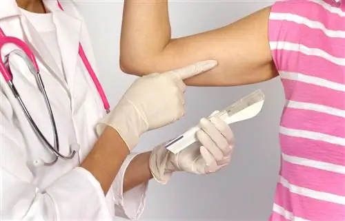 Врач с противозачаточным имплантатом