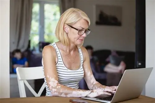 Витилиго болезненно?