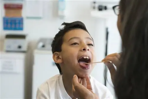 Гингивостоматит: обзор и многое другое