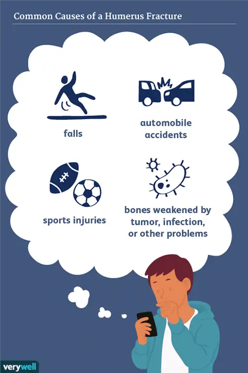 Распространенные причины перелома плечевой кости